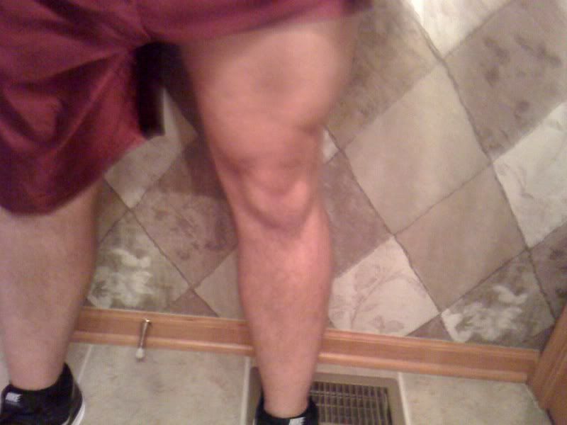 leg.jpg