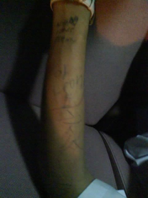 kl's hand