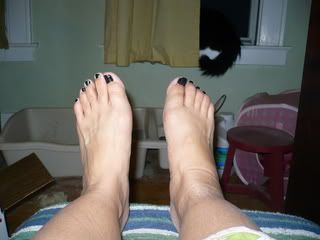 Right foot swollen, left foor normal