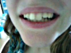 Teeth-1.jpg